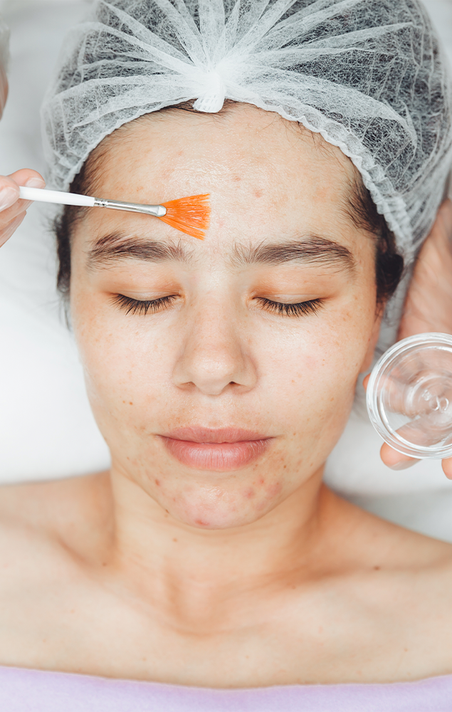 The 5 Most Common Skin Concerns – and the Best Facial Treatments for Each